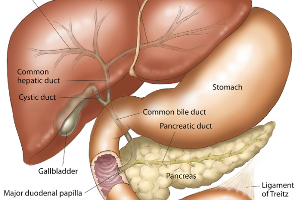 PERTs for Chronic Pancreatitis
